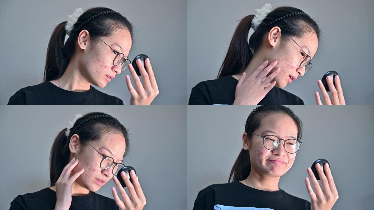 年轻的亚洲妇女担心痤疮炎症和痤疮疤痕会在她的脸被镜子看到后出现在她的脸上。