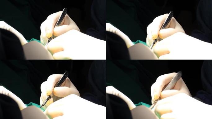医生在手术期间拿着柳叶刀。医生手中的特写镜头。