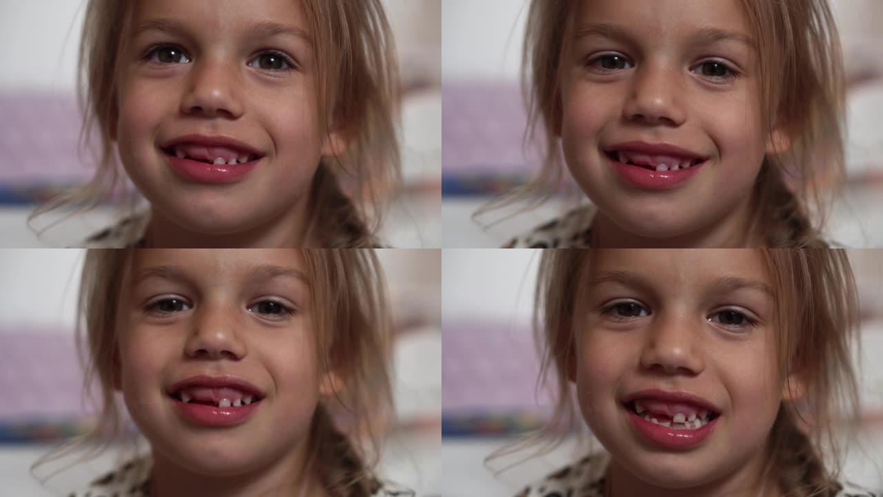 女孩的特写微笑。一个6-7岁的漂亮小女孩掉了乳牙。乳牙脱落，恒牙更换。快乐微笑的孩子是牙科。白牙脸。