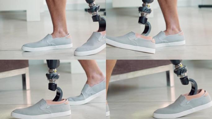 截肢者使用假肢行走进行假肢康复锻炼。