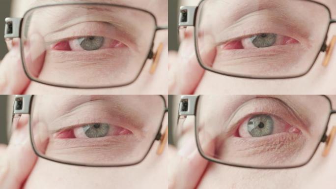 白种人中年男性灰色眼睛用屈光度矫正眼镜拉伸眼睑看得更好，明亮的特写