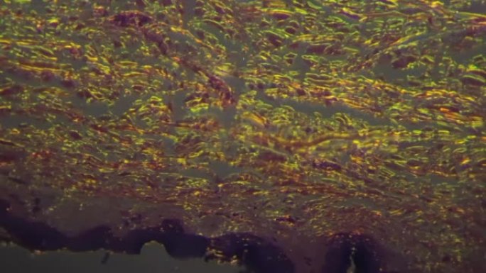 在100x显微镜下用交叉光拍摄人体皮肤上的汗腺