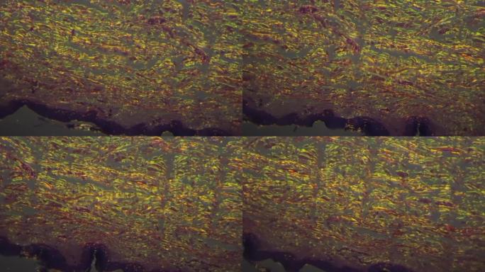 在100x显微镜下用交叉光拍摄人体皮肤上的汗腺