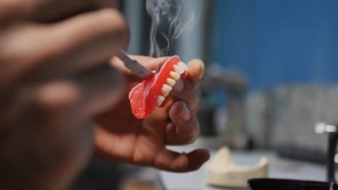 通过加热金属板，牙科技术人员通过熔化蜡坯并使假体边缘光滑来模拟可移动假体的形状。蜡融化和抽烟