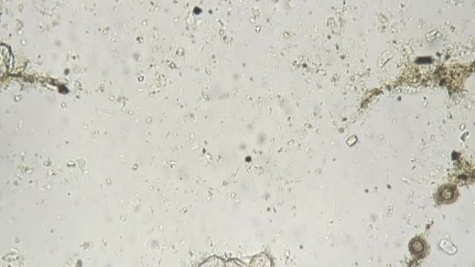 显微镜下的猪绦虫卵全坐骑在白色背景下放大200倍