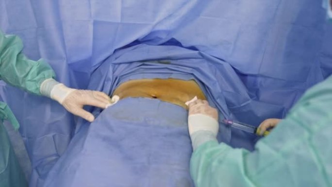 医生的手戴着乳胶手套，用一个长长的大注射器注射到病人的腹部。病人肚脐里有血。从上方观看。