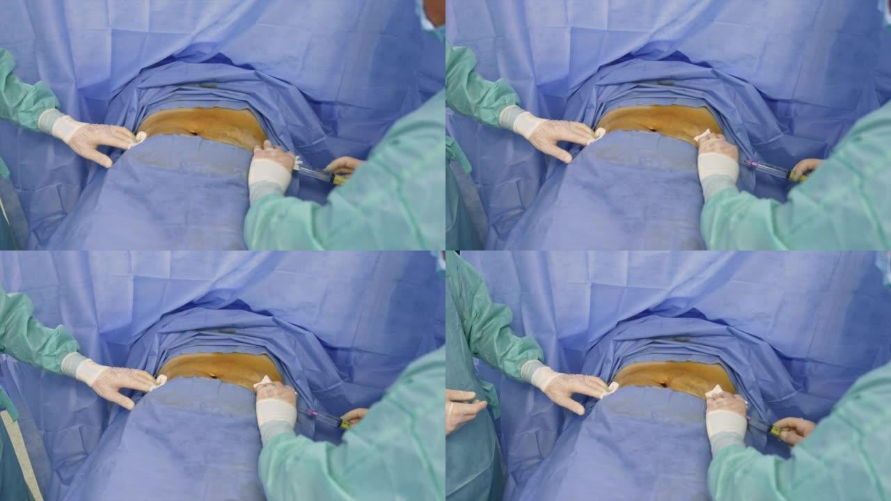 医生的手戴着乳胶手套，用一个长长的大注射器注射到病人的腹部。病人肚脐里有血。从上方观看。