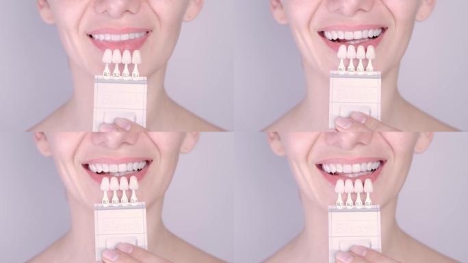 完美的白色牙齿关闭与阴影引导漂白颜色，女性贴面微笑，牙科护理和口腔科，牙科。