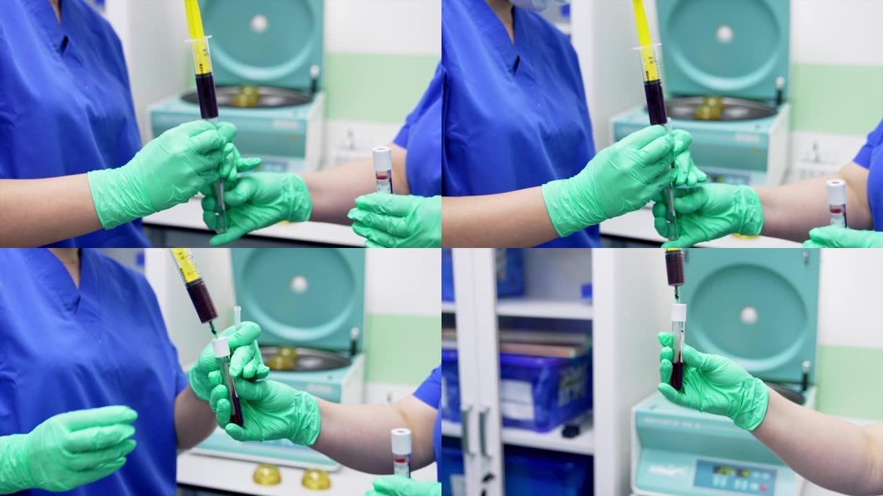 深色血液从注射器转移到试管中。两名戴着乳胶手套的医生用病人的血液填充试管。特写。