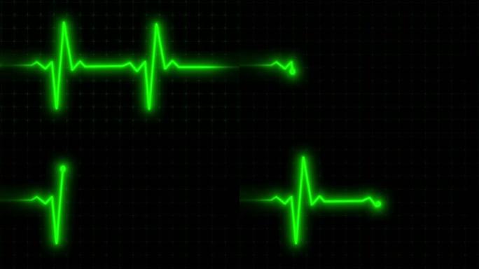 心跳脉搏心电图动画，黑底心电图心跳动画，心律心电图，心电图。心电图心跳脉搏循环动画视频，心跳监护心电