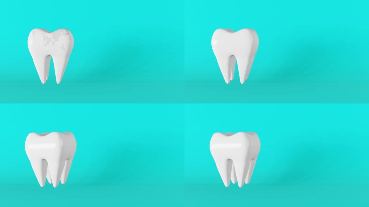 龋齿解剖模型。白色健康磨牙运动3D循环旋转动画蓝色背景。牙医日智齿拔牙口腔护理牙垢牙菌斑牙釉质美白恢