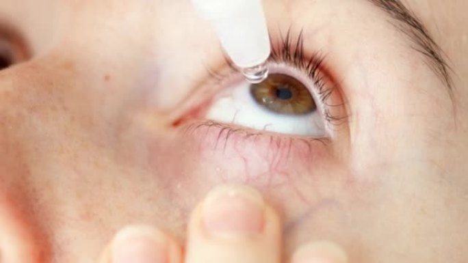 特写女孩滴眼液安装镜片，保湿，使用患有干眼症或治疗眼科疾病的医用滴眼液，视力模糊的女士，治疗眼睛。