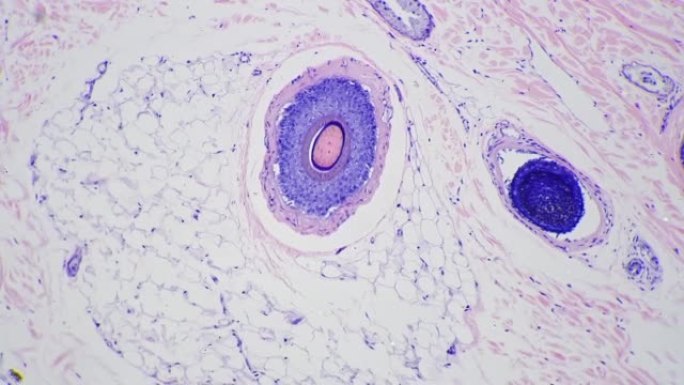 在显微镜下放大100倍的切片中显示有毛囊的人皮肤