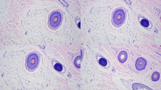 在显微镜下放大100倍的切片中显示有毛囊的人皮肤