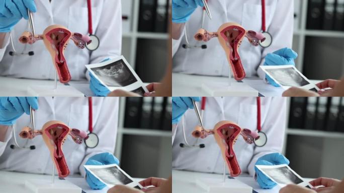 妇科医生展示了子宫的解剖结构和女性生殖系统的x射线