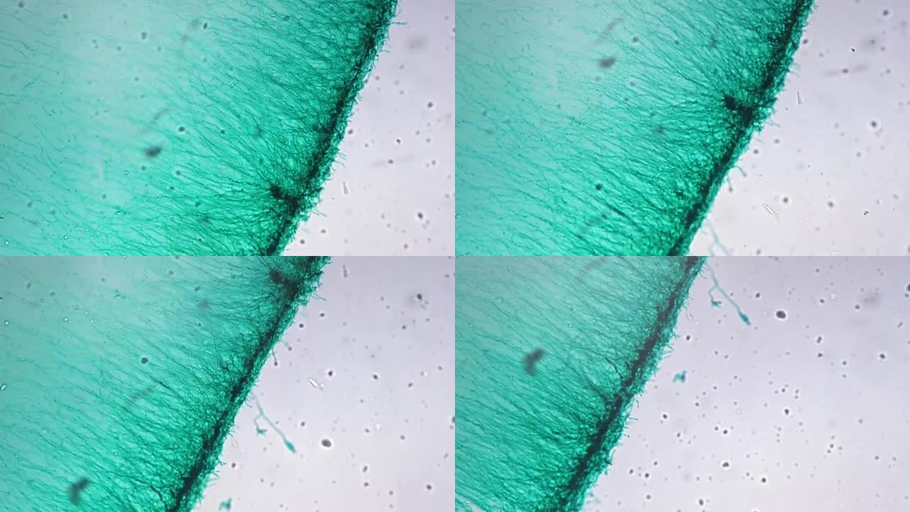 青霉菌样品w.M.在200倍放大倍率的明亮视野下在显微镜下拍摄
