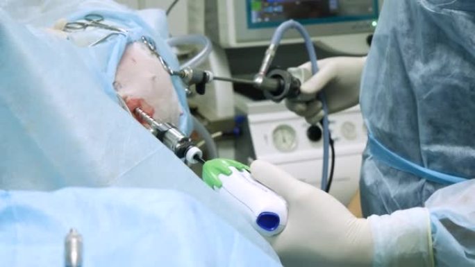 一位经验丰富的医生在动物的小腹部熟练地使用内窥镜仪器。用乳胶无菌手套，外科医生专业操作内窥镜设备。