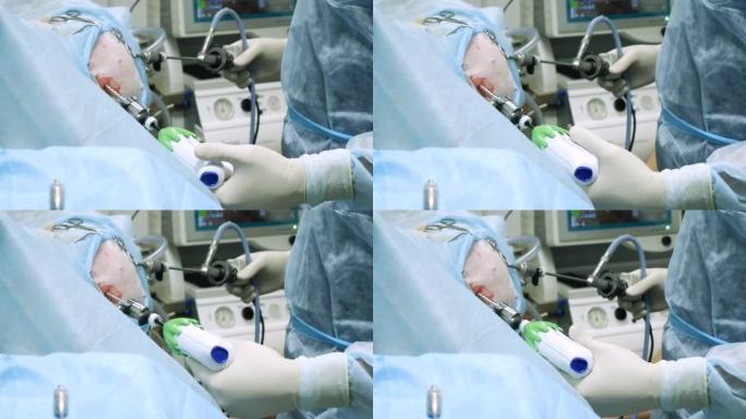 一位经验丰富的医生在动物的小腹部熟练地使用内窥镜仪器。用乳胶无菌手套，外科医生专业操作内窥镜设备。