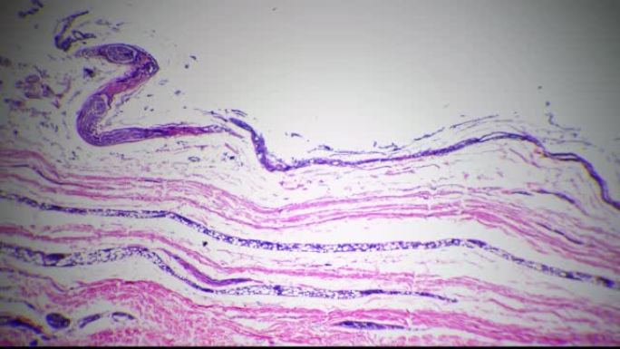 Microscopic 40x image of human skin with sweat gla