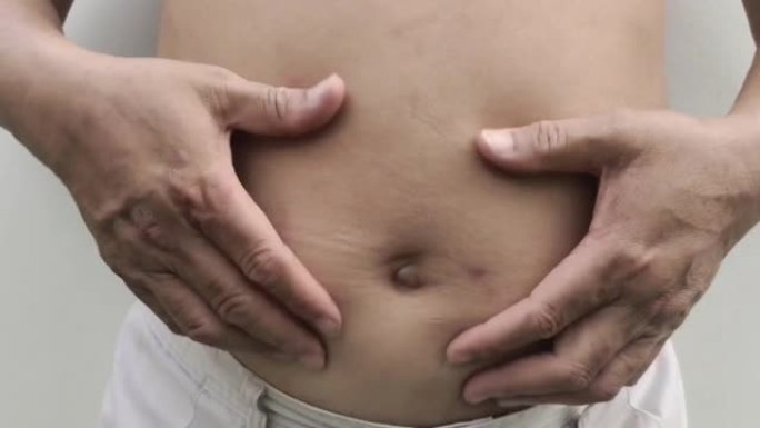 脂肪脂肪围绕腰部，胖乎乎的脂肪在男性的腹部。