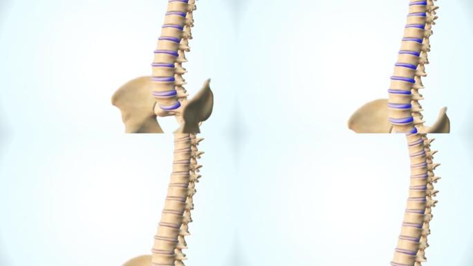 脊柱骨软骨病的类型