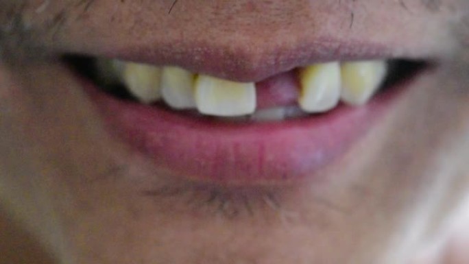 晒黑亚洲男性嘴唇特写，男性微笑概念，断牙