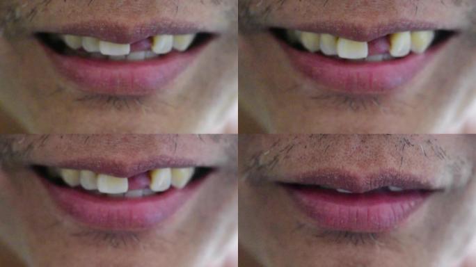 晒黑亚洲男性嘴唇特写，男性微笑概念，断牙