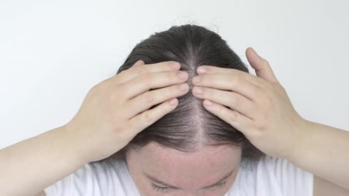 女性以纤细的头发控制脱发和少量头发