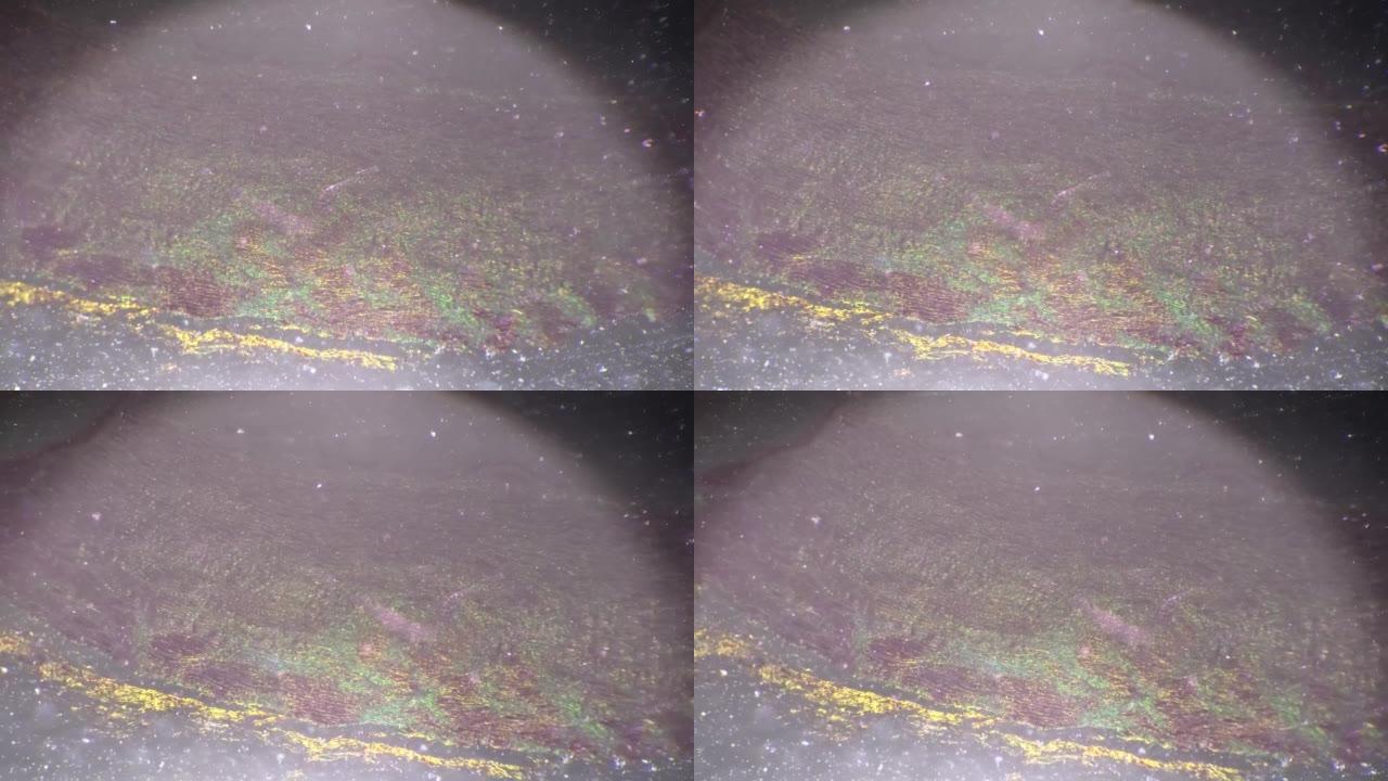 斜向照明拍摄的单纯性鳞状上皮40x显微图像