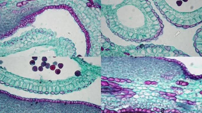 顶芽在显微镜下400x的纵向截面上对着明场拍摄