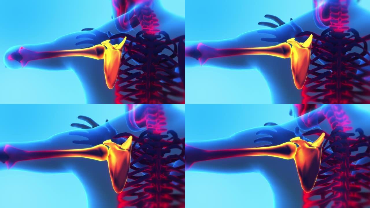 成年男性感到肩部疼痛。X射线3D动画。