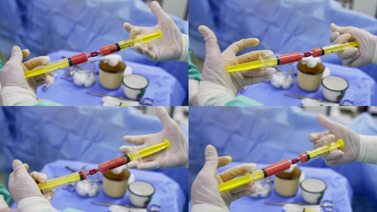 将干细胞从一个注射器移动到另一个注射器。外科医生戴着手套准备干细胞进行手术。特写。