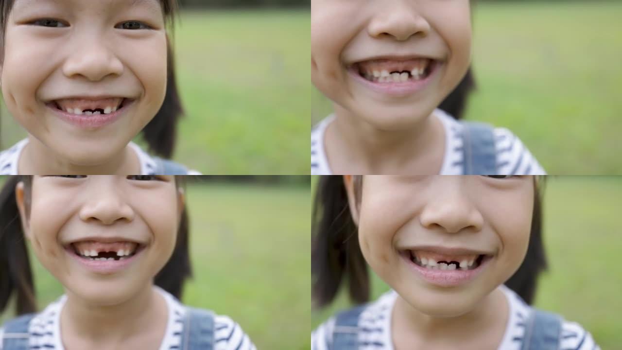 年轻快乐的亚洲小女孩的肖像在公园玩得开心。特写笑脸女孩。7岁漂亮的小女孩掉了乳牙。乳牙脱落，恒牙更换