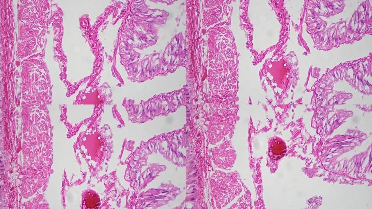 在明亮的视野背景下，在400倍的显微镜下在横向剖面上拍摄了worm