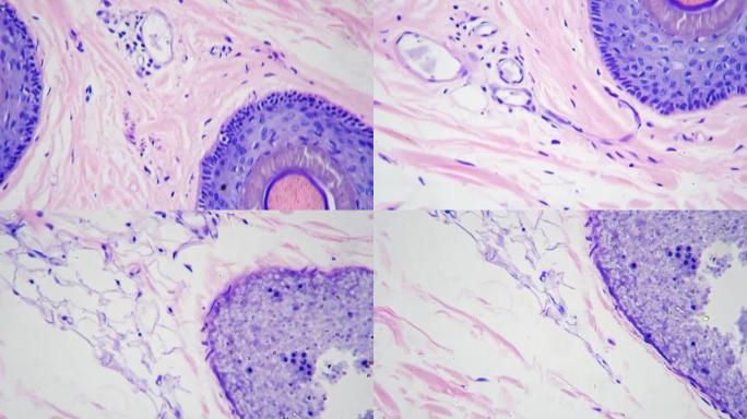在显微镜下放大200倍的切片中显示有毛囊的人皮肤