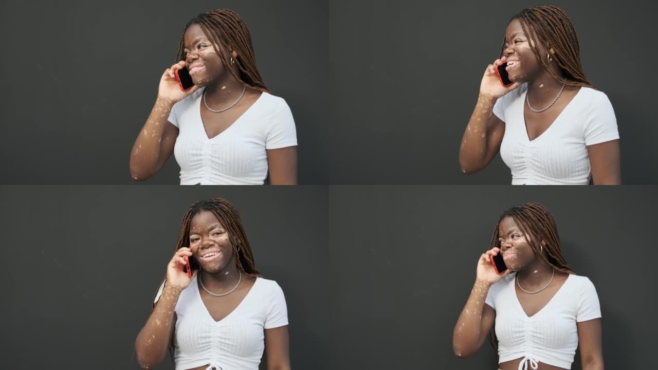 患有白癜风的年轻非洲裔美国妇女在电话里微笑着。