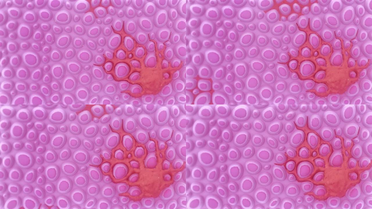 黑素细胞，皮肤蔓延粉红色血液分散。