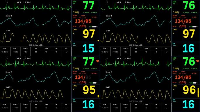 心电系统监测患者心脏器官健康状况的接口