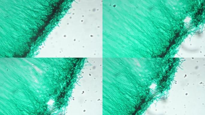 青霉菌样品w.M.在400倍放大倍率的明亮视野下在显微镜下拍摄