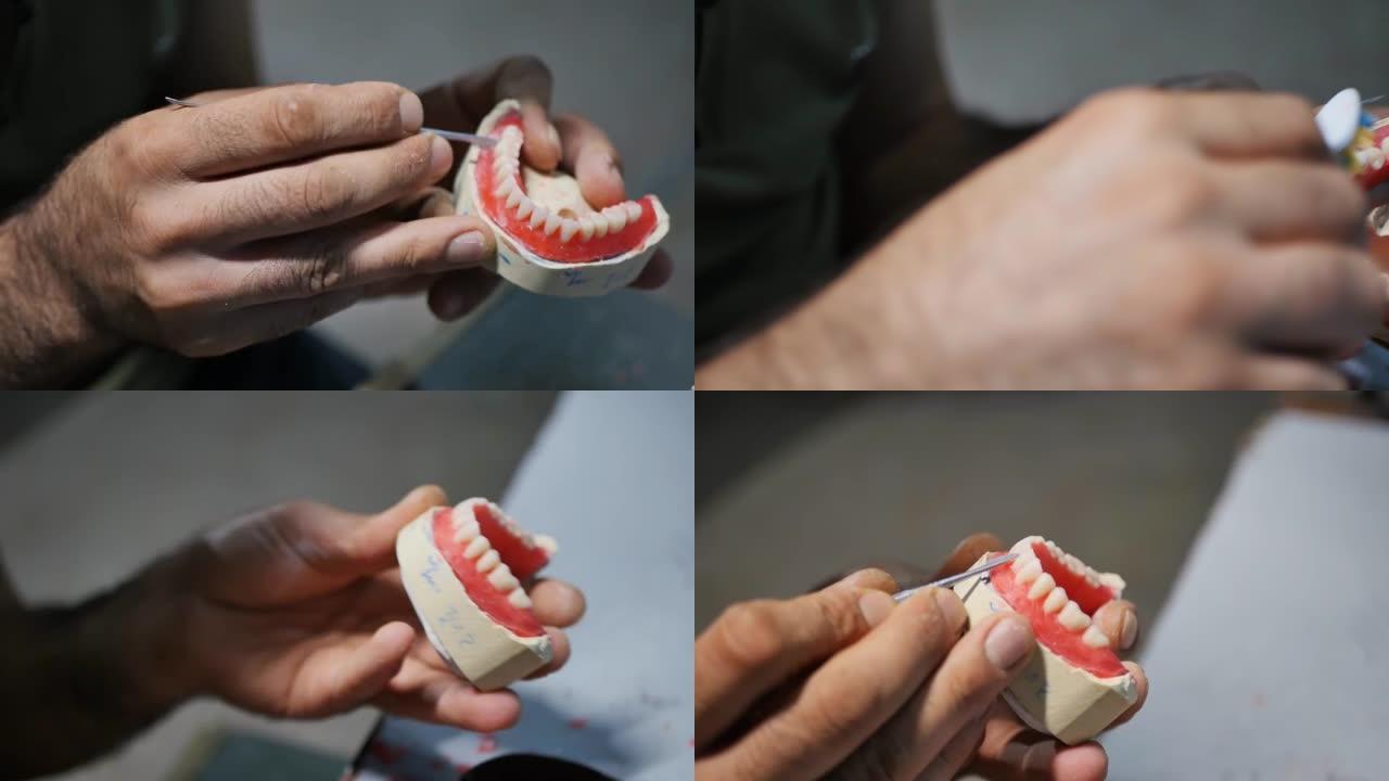 拿着锋利的手术刀的牙科技师的手正在对可移动的牙齿假体进行建模，以切掉制成假体牙龈的红色蜡。