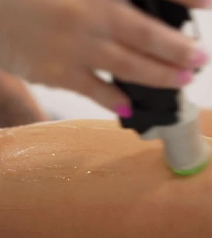 垂直近距离视频的专业美容师做激光脱毛的腿年轻女子在美容院
