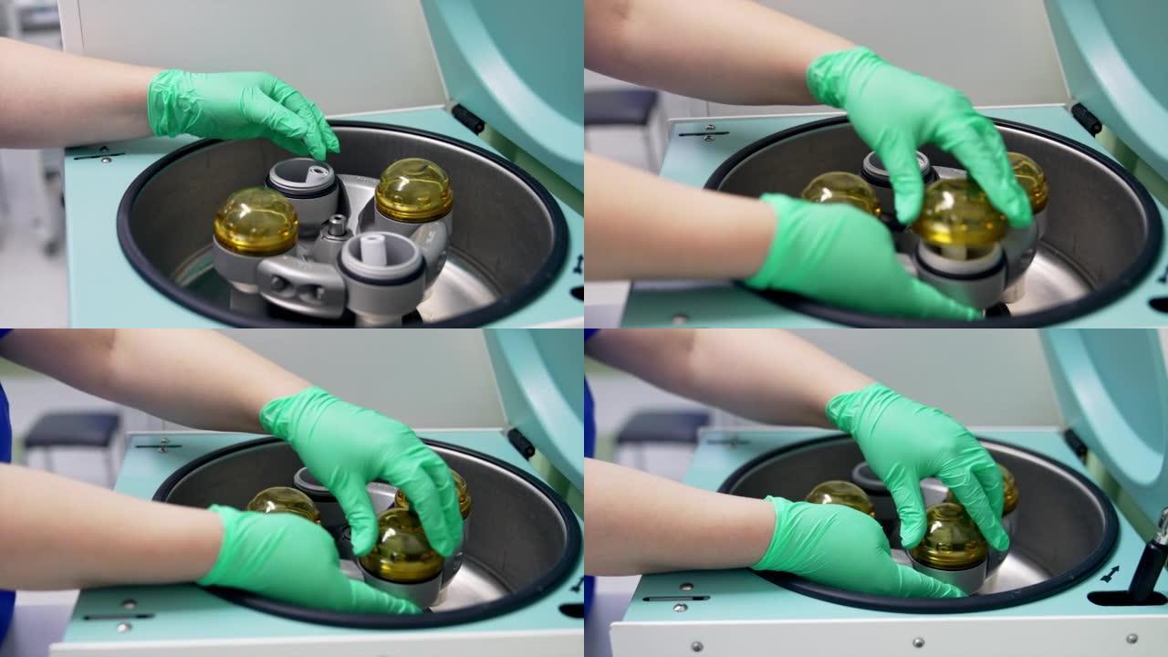 双手戴着绿色乳胶手套，将带有血液的试管放入储液罐中。等离子体制备设备关闭。