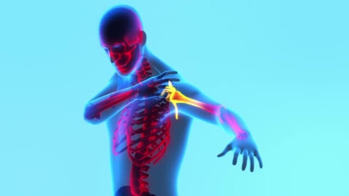 人体骨骼x射线图像。感到肩膀疼痛。