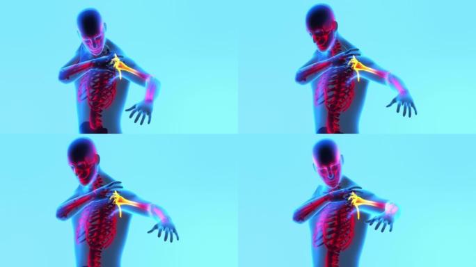 人体骨骼x射线图像。感到肩膀疼痛。