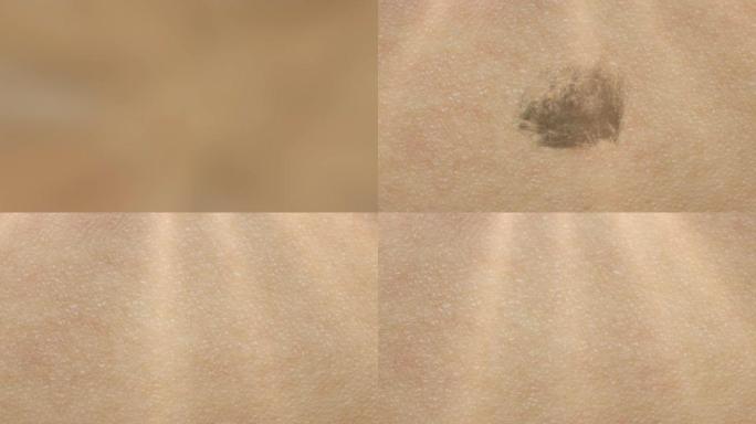 3D动画特写球霜血清胶原蛋白修复效果皮肤去污。深层清洁皮肤。皮肤毛孔。痤疮清洁。皮肤毛孔清洁
