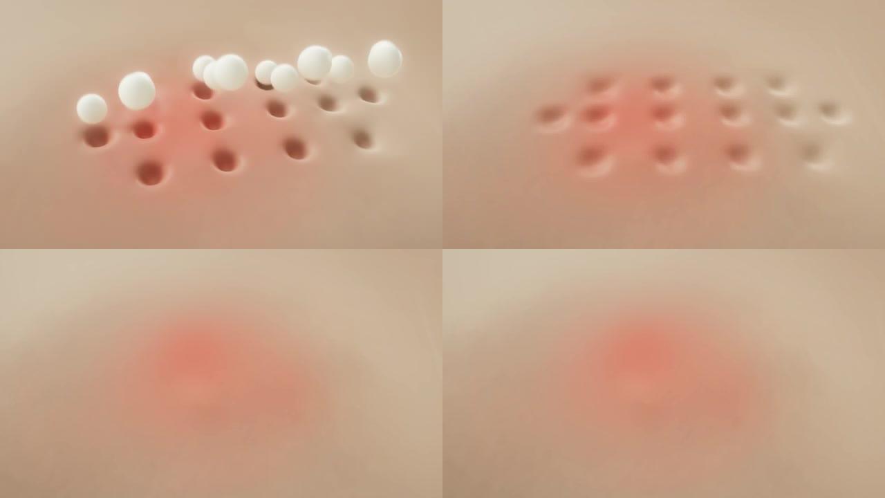 3D动画皮肤痤疮细胞原子分子修复效果