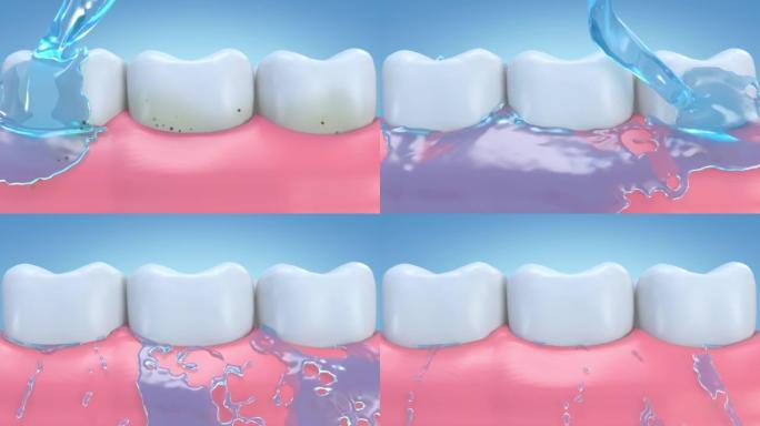 3d动画呈现蓝色液体清洁牙龈和牙齿