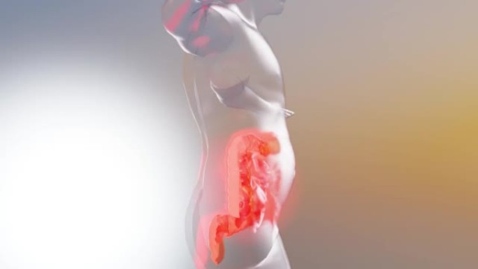 肠易激综合征 (IBS)，胃炎，消化性溃疡，胰腺炎。胃部疼痛抽筋，腹部严重腹痛，人体消化系统解剖，3