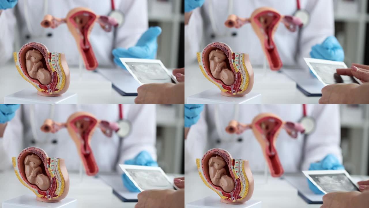 妇科医生的桌子上是带有胎儿的模型子宫