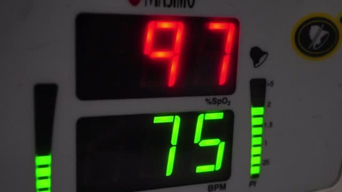 脉搏血氧计频率平稳医疗器械